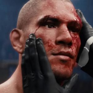 EA Sports UFC 5 Ispezione Delle Lesioni